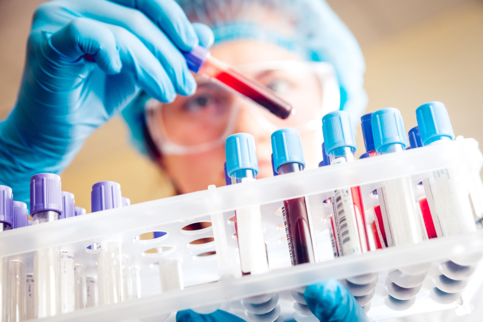 Diagnostic Testing