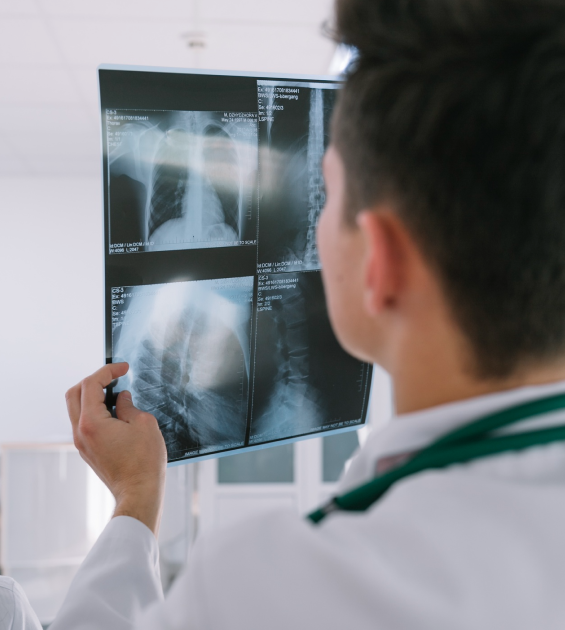 Doctor checking Xray