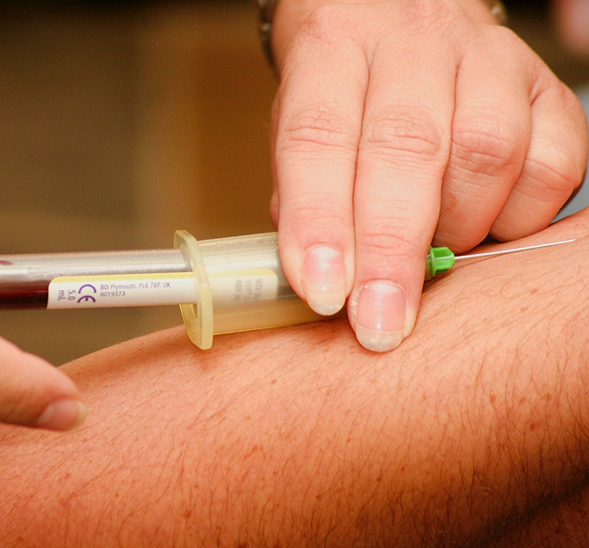 QuantiFERON-TB (IGRA Blood Test)