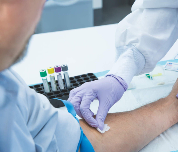 What is TB and Why Testing Matters for Your Health