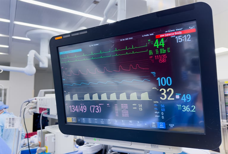 On-site EKG testing