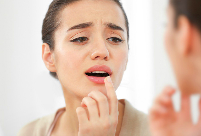 cold sores treatment