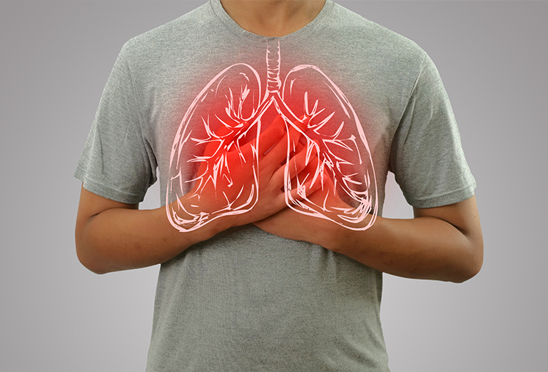 bronchitis treatment