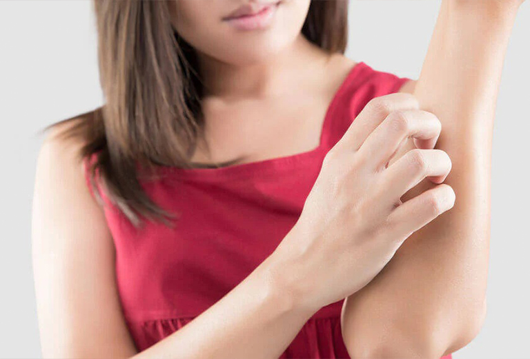 Poison ivy treatment